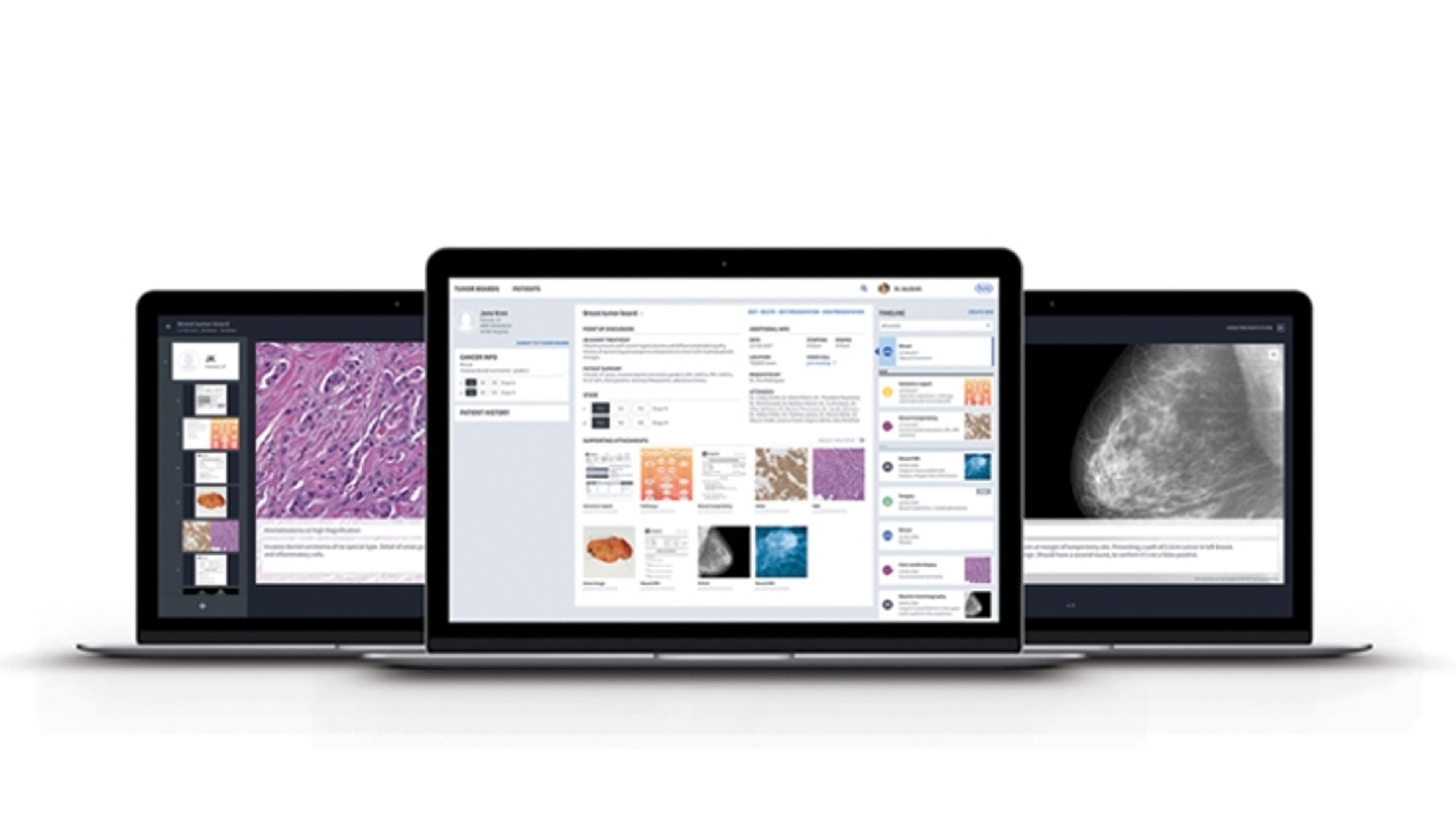 NAVIFY Tumor Board - null - Clinical Diagnostics