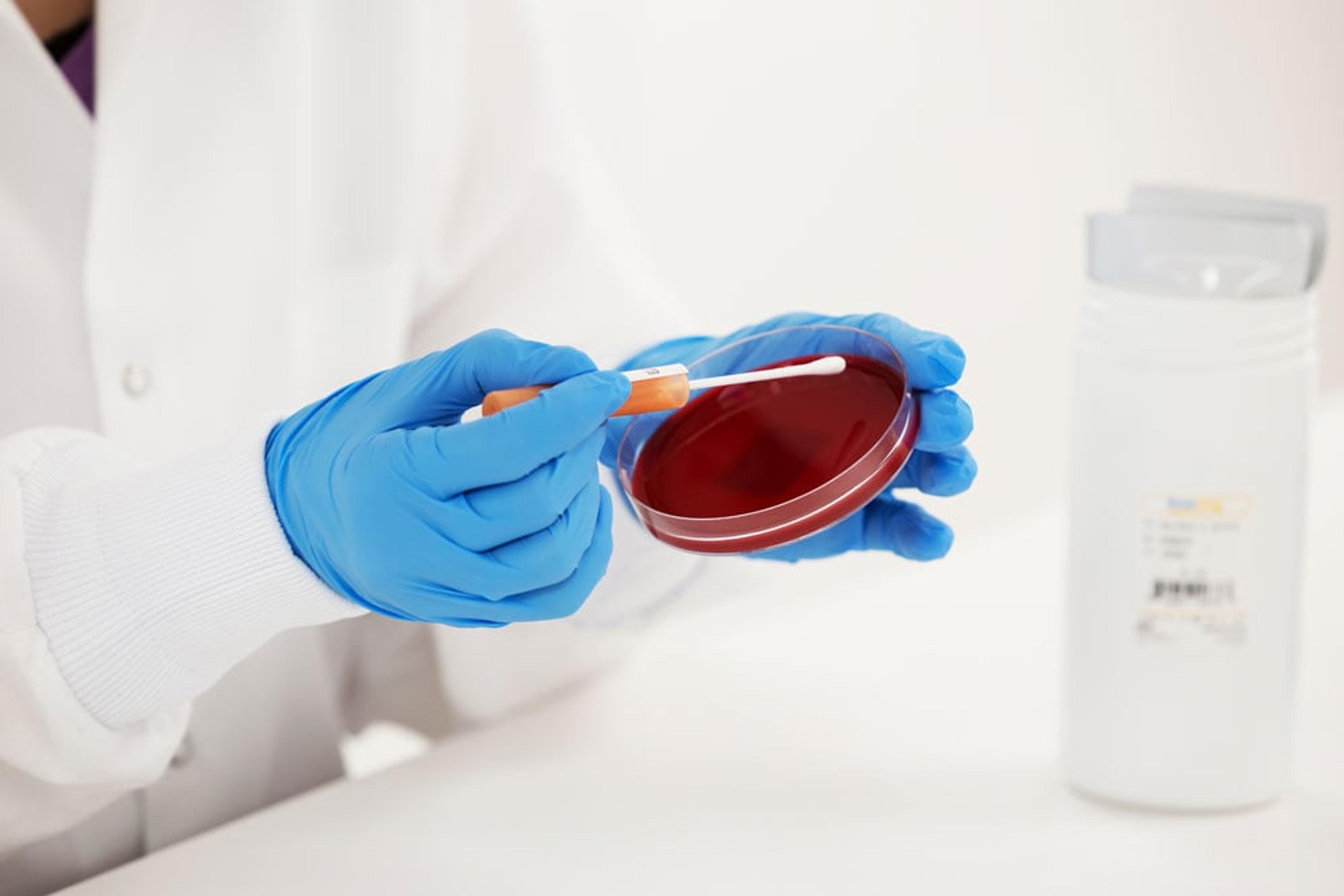 KWIK-STIK - Staphylococcus aureus derived from ATCC® 43300™ - Microbiologics - Life Sciences