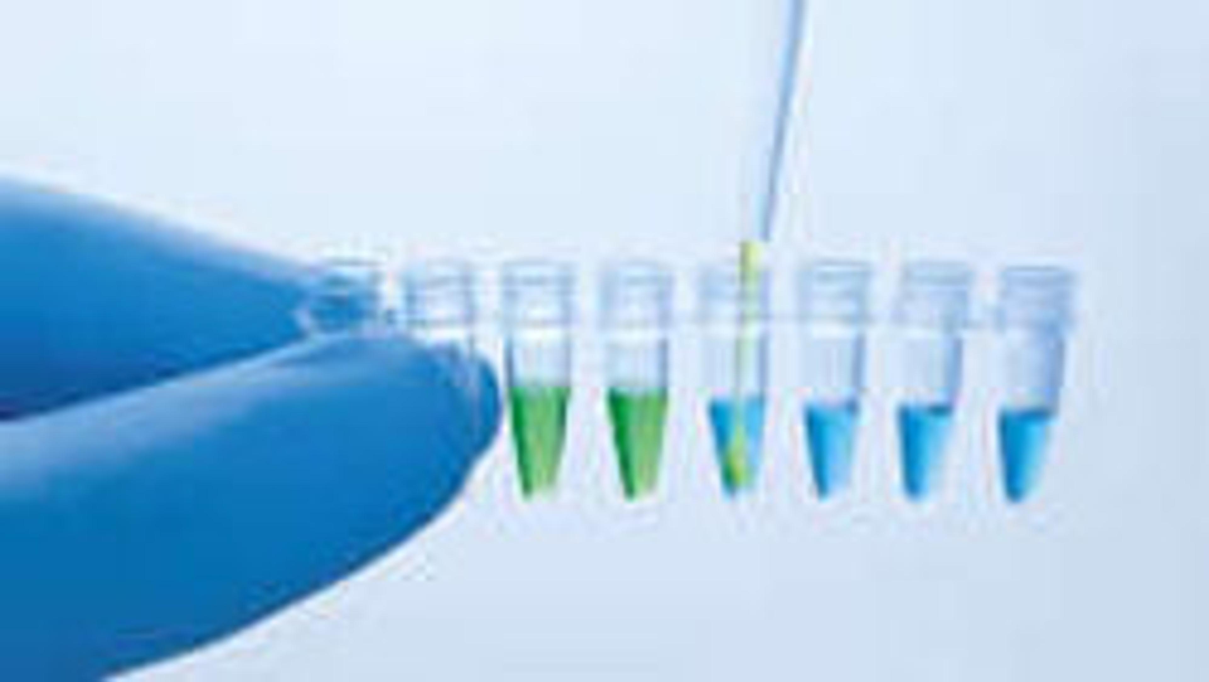 UCP Probe PCR Kit (100) - QIAGEN