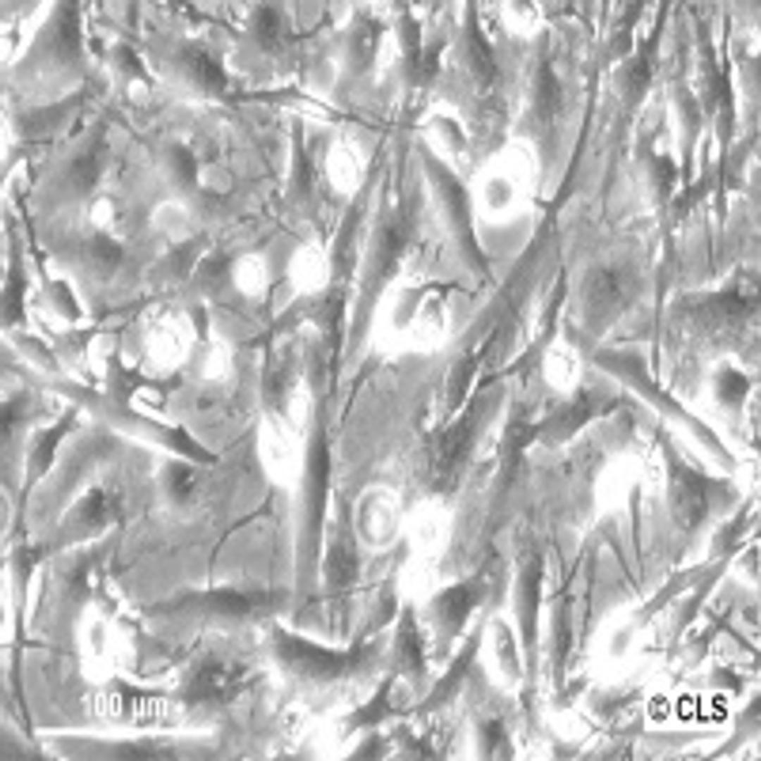 U-251 MG - Cell Lines Service GmbH - Life Sciences