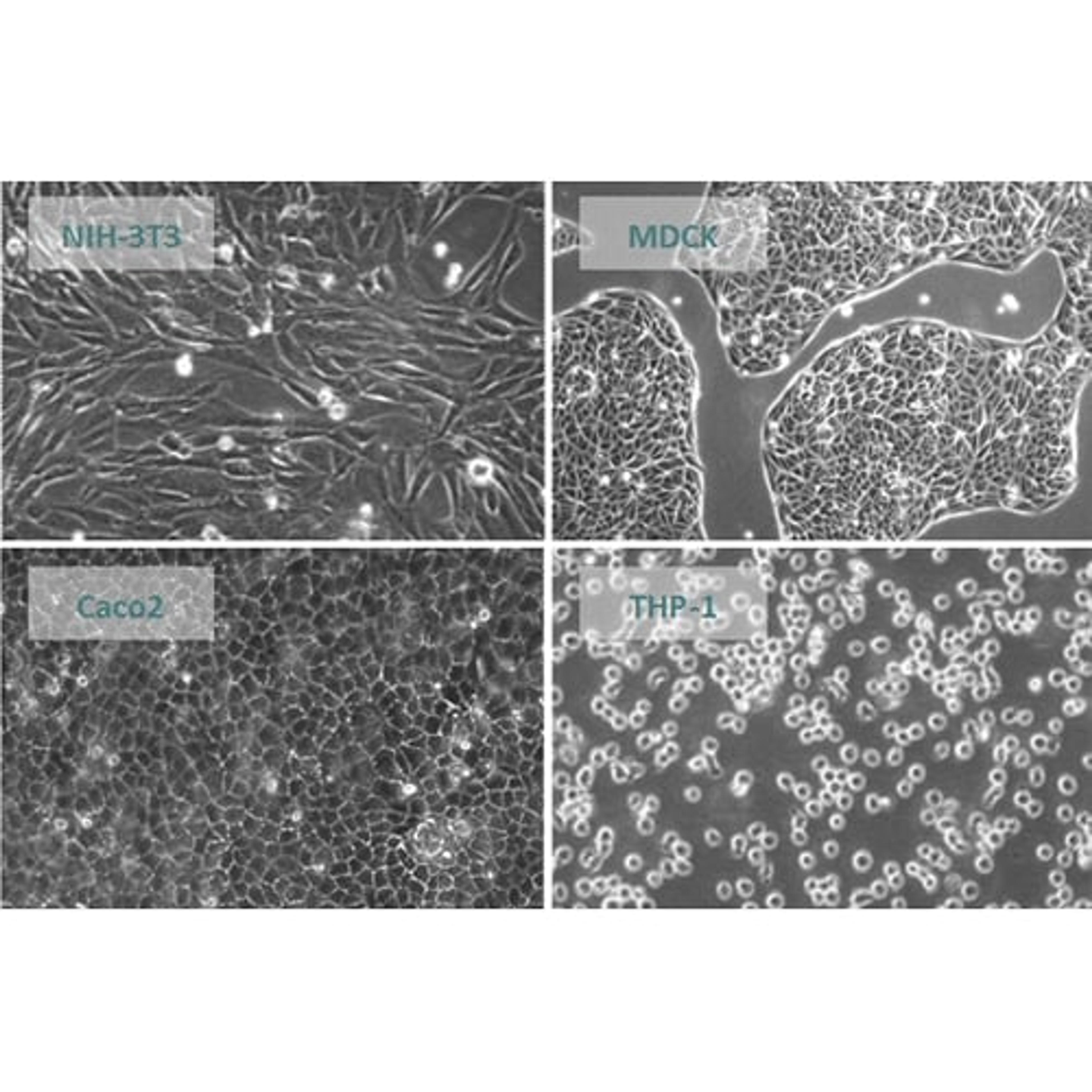 Assay Ready Cells - accellerate - Drug discovery > Lead Discovery