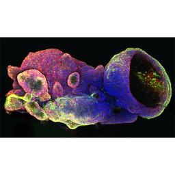 Cultrex UltiMatrix Reduced Growth Factor Basement Membrane Extract - Bio-Techne - Life Sciences