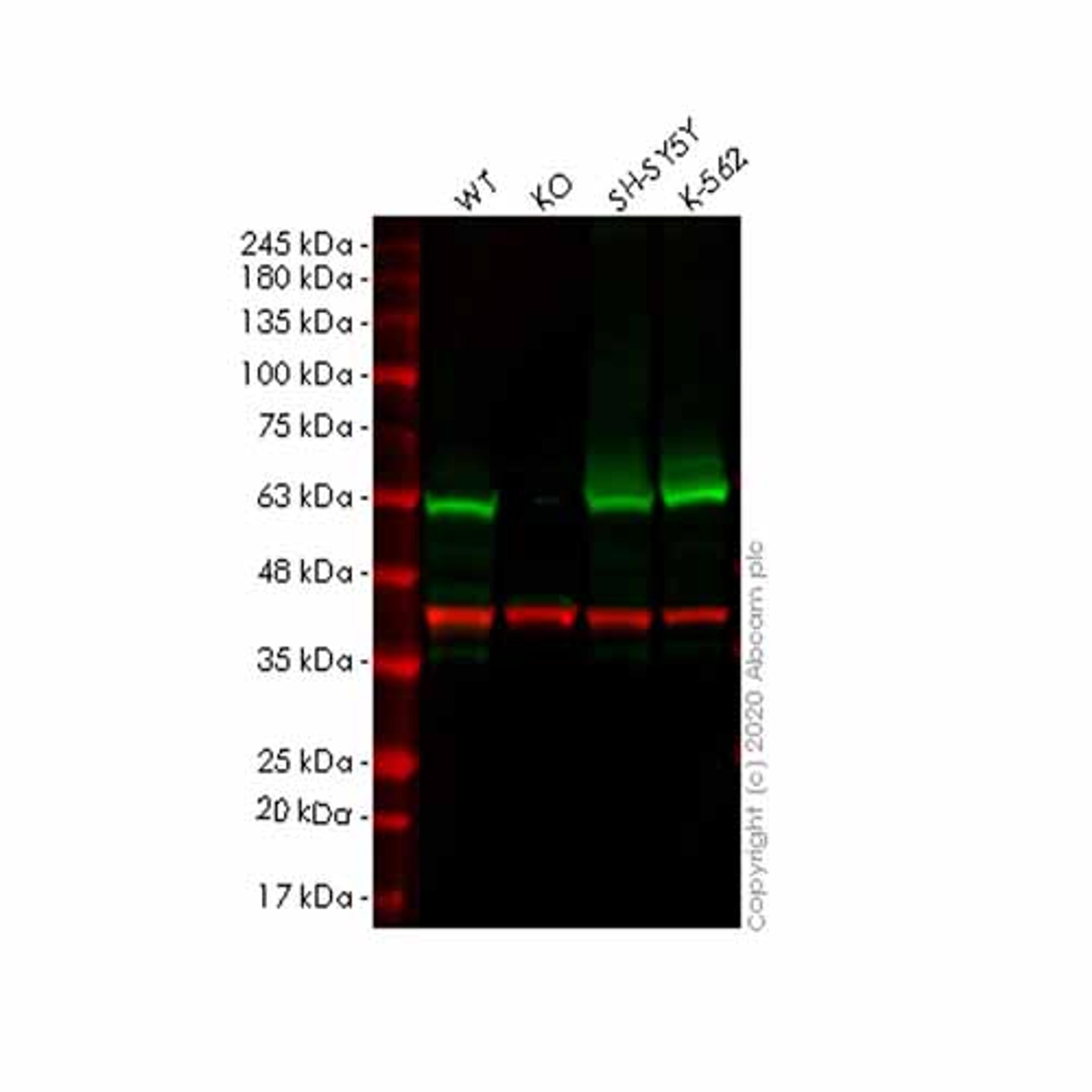 Human FSCN1 (Fascin) knockout HCT116 cell line - Abcam plc - Life Sciences