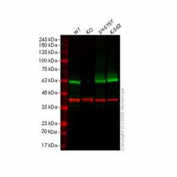Human FSCN1 (Fascin) knockout HCT116 cell line - Abcam plc - Life Sciences
