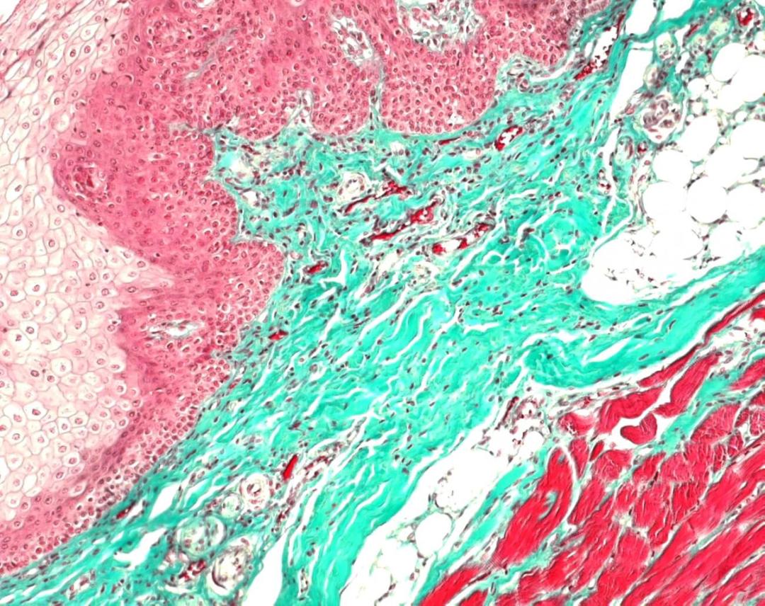 Masson-Goldner - Merck KGaA, Darmstadt, Germany - Clinical Diagnostics