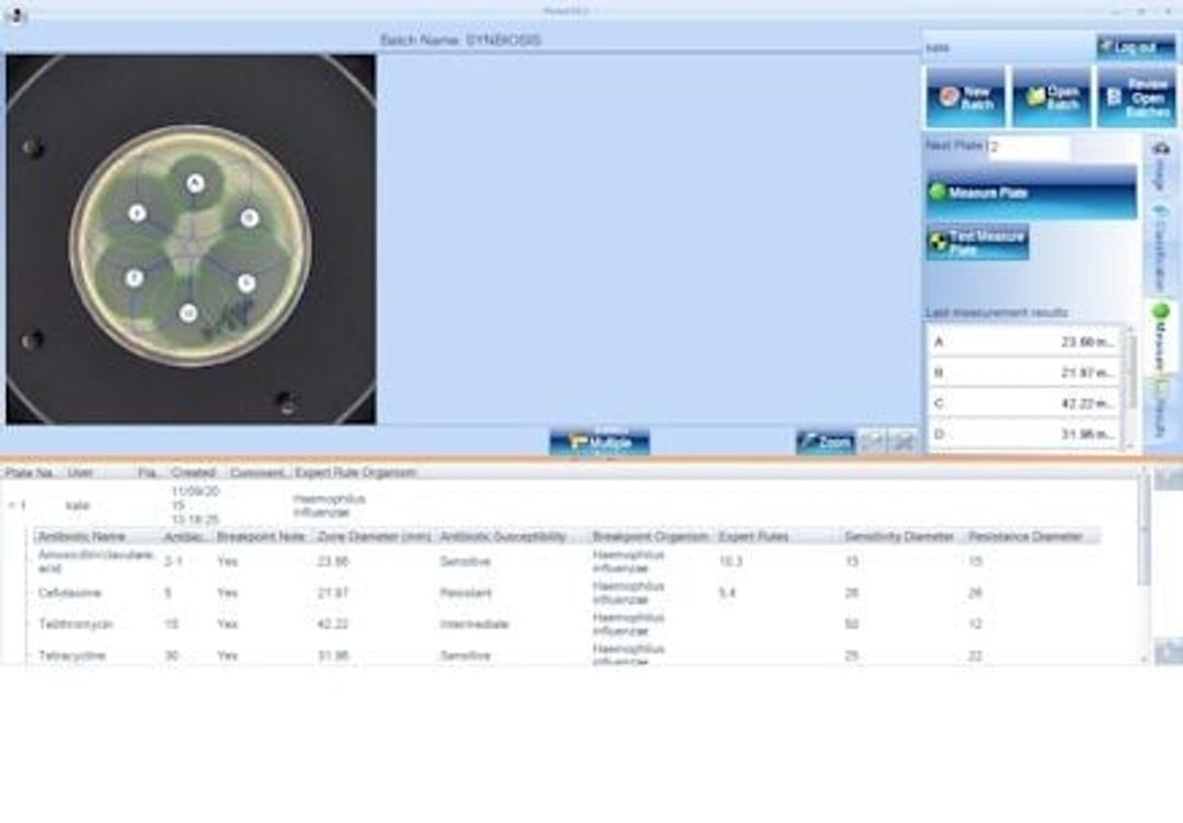 eAST Software - Antibiotic Susceptibility Testing - Synbiosis - Life Sciences