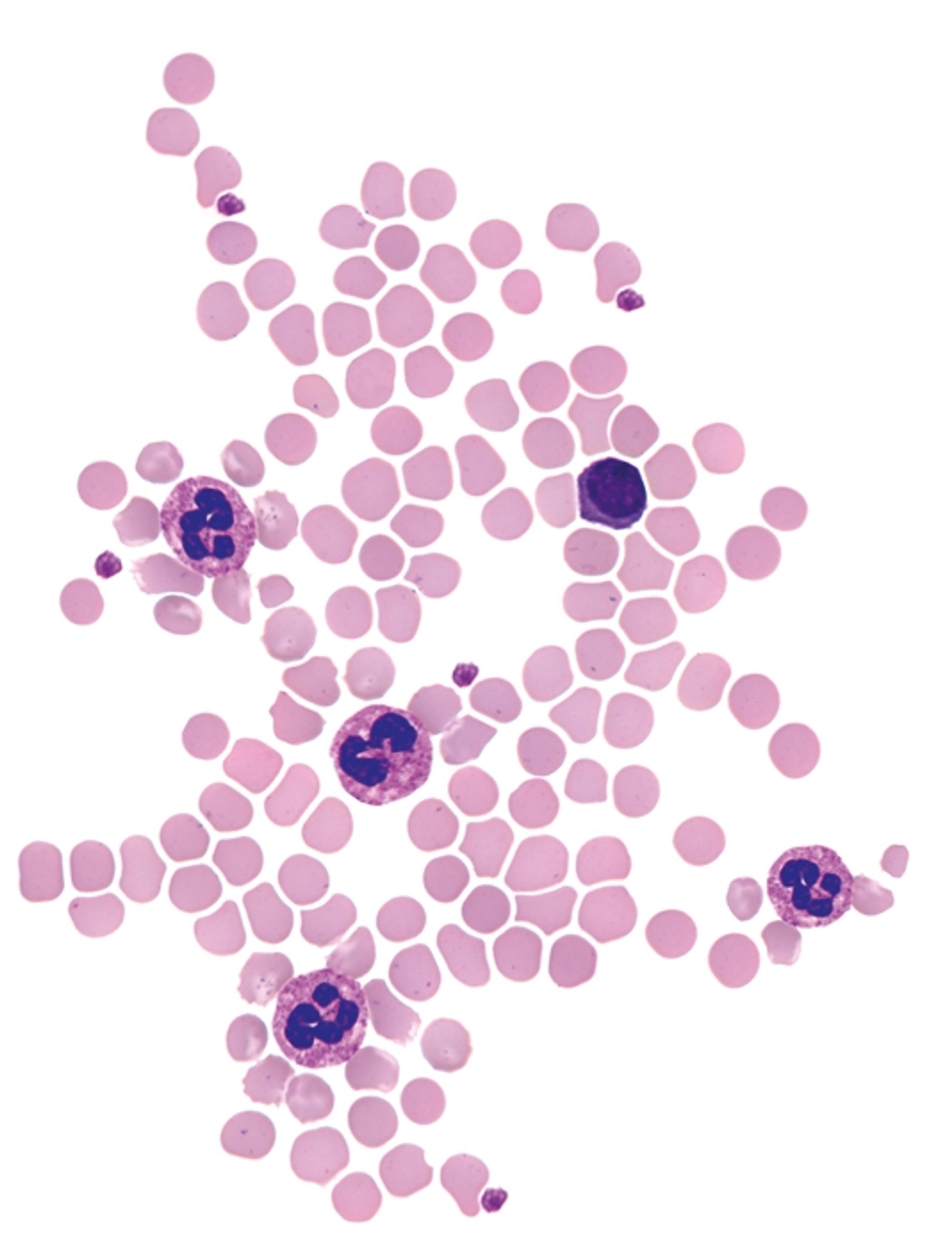 Hematology Staining Solutions - Merck KGaA, Darmstadt, Germany - Clinical Diagnostics
