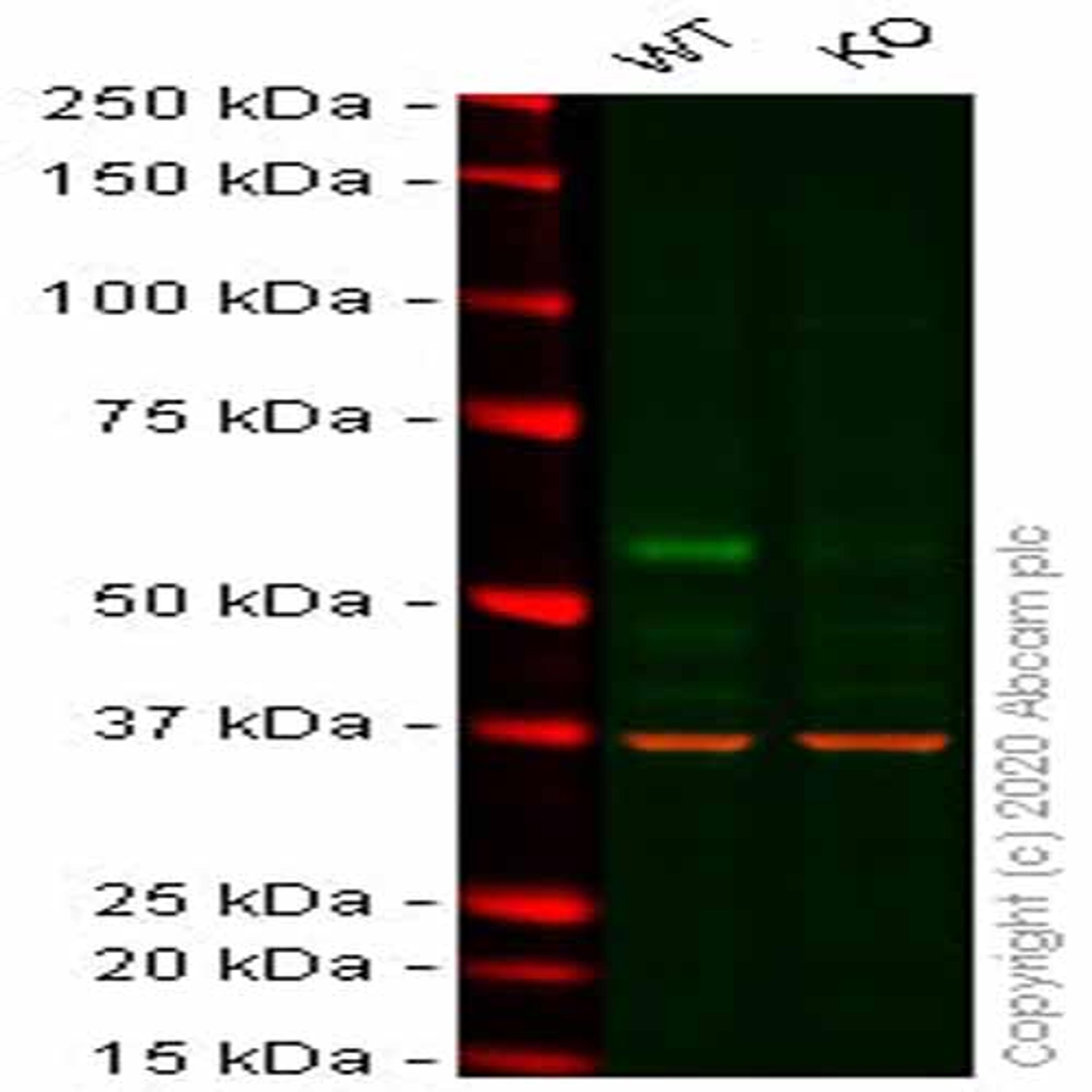 Human ELK1 knockout HeLa cell line - Abcam plc - Life Sciences