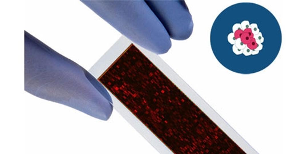 PEPperCHIP® Cancer Antigen Microarrays - PEPperPRINT GmbH - Life Sciences