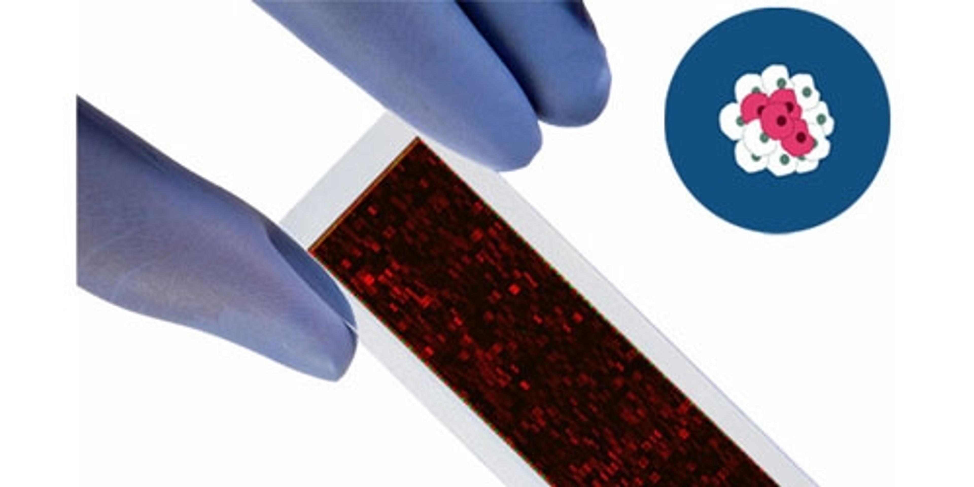 PEPperCHIP® Cancer Antigen Microarrays - PEPperPRINT GmbH - Life Sciences