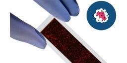 PEPperCHIP® Cancer Antigen Microarrays - PEPperPRINT GmbH - Life Sciences