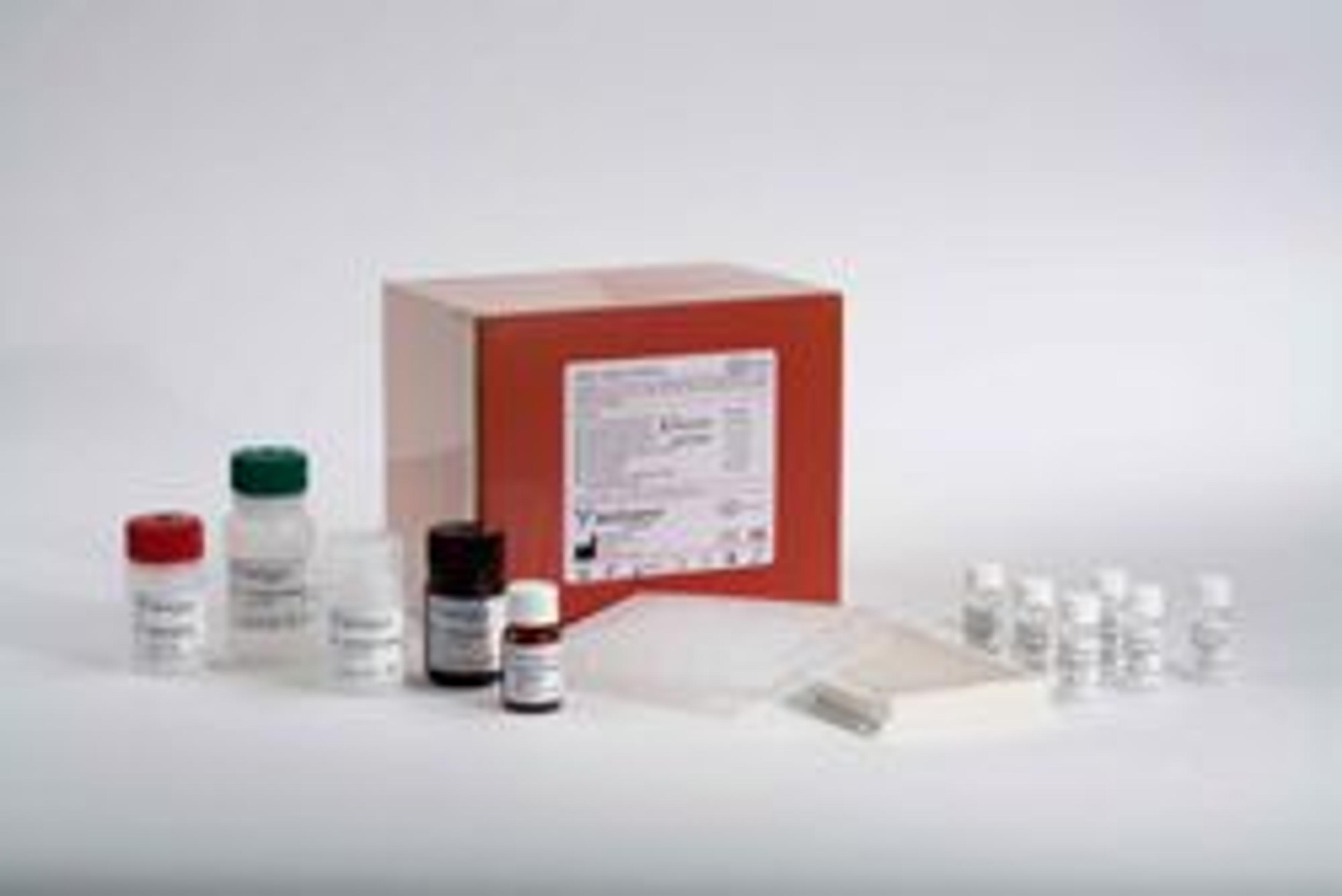 NGAL Rapid ELISA Kit - BioPorto Diagnostics A/S - Life Sciences