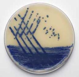 Brilliance MRSA AGAR - Thermo Fisher Scientific - Life Sciences