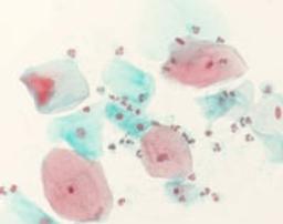 Shorr staining solution - Merck KGaA, Darmstadt, Germany - Clinical Diagnostics