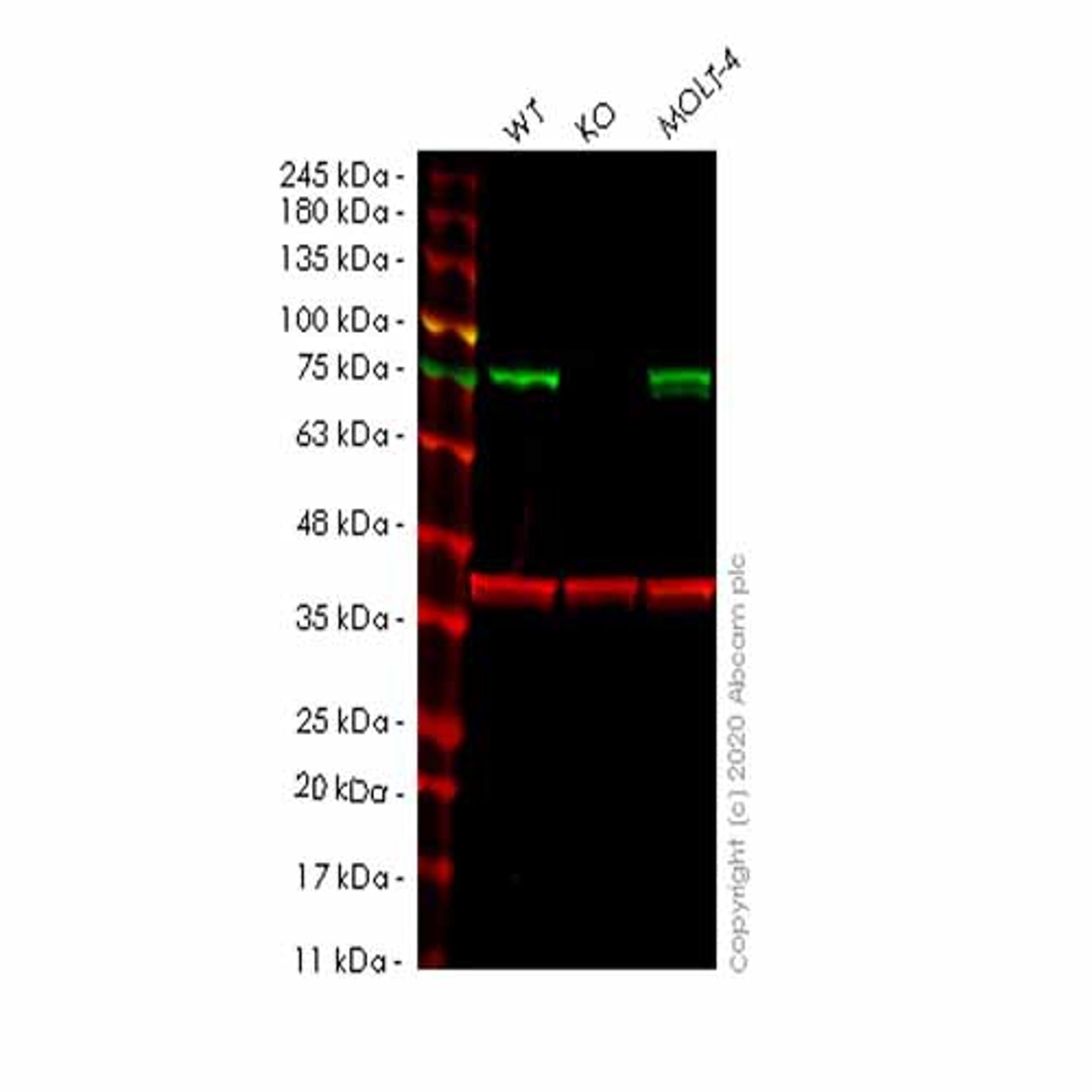 Human TRMT2A (HTF9C) knockout HeLa cell line - Abcam plc - Life Sciences
