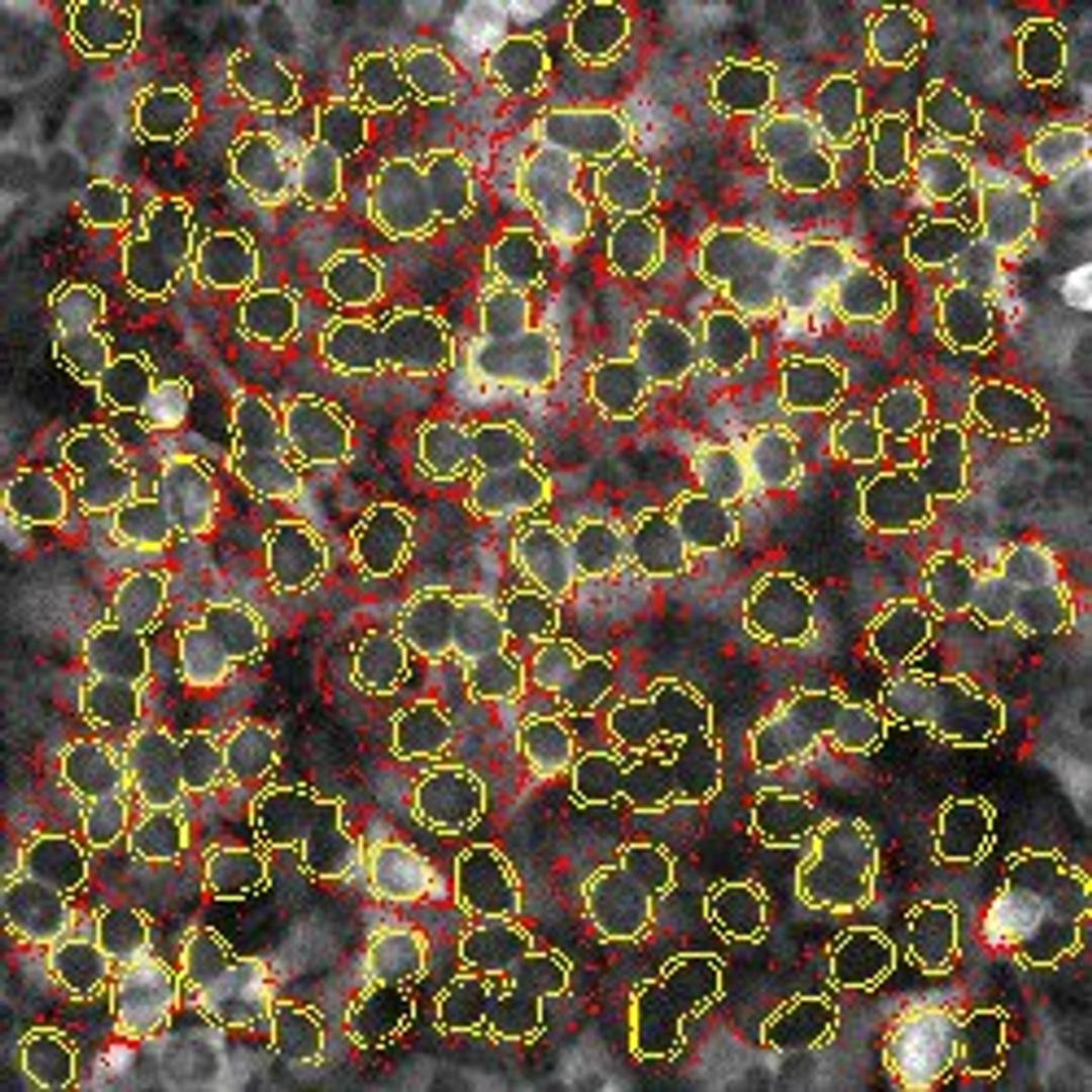 Cyto-Cell Membrane Translocation V2 Image Analysis BioApplication - null - Life Sciences