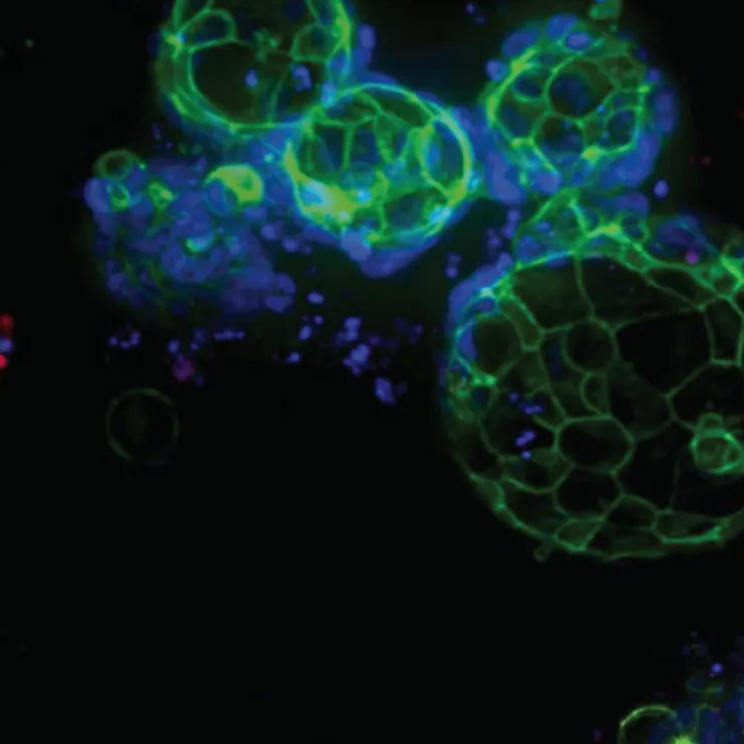 3D Ready™ Organoids - Molecular Devices® - Life Sciences