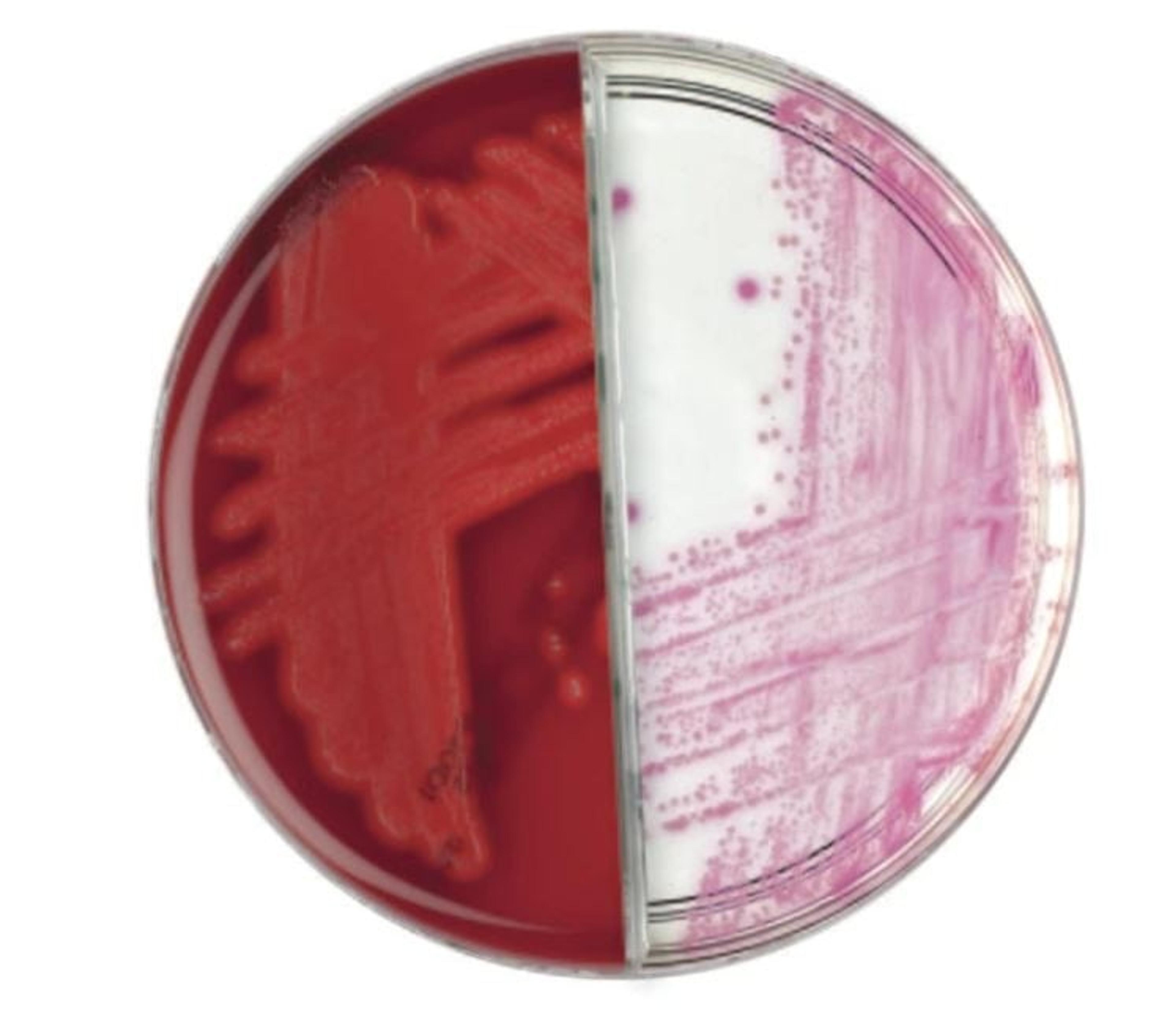 Thermo Scientific™ Oxoid™ Columbia CNA Agar/ Thermo Scientific™ Brilliance™ GBS Agar Biplate - Thermo Fisher Scientific - Life Sciences