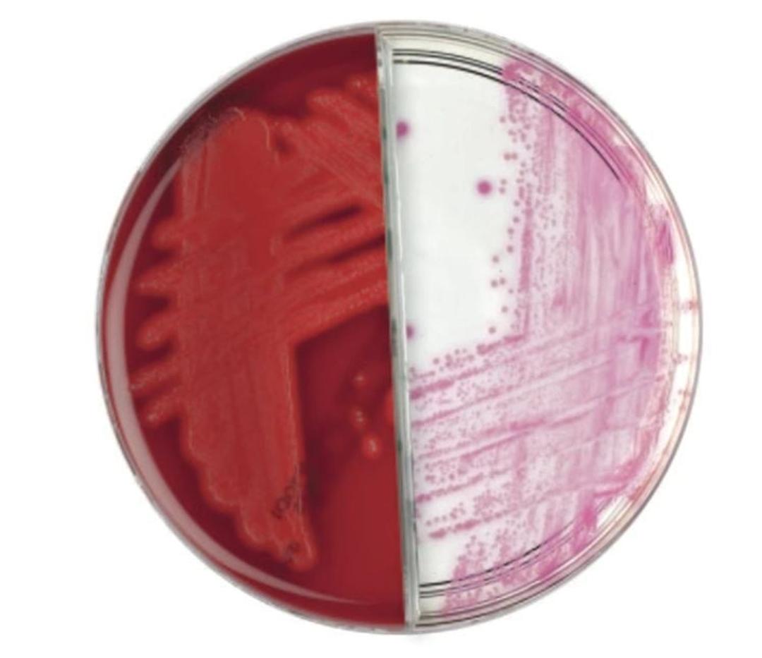 Thermo Scientific™ Oxoid™ Columbia CNA Agar/ Thermo Scientific™ Brilliance™ GBS Agar Biplate - Thermo Fisher Scientific - Life Sciences