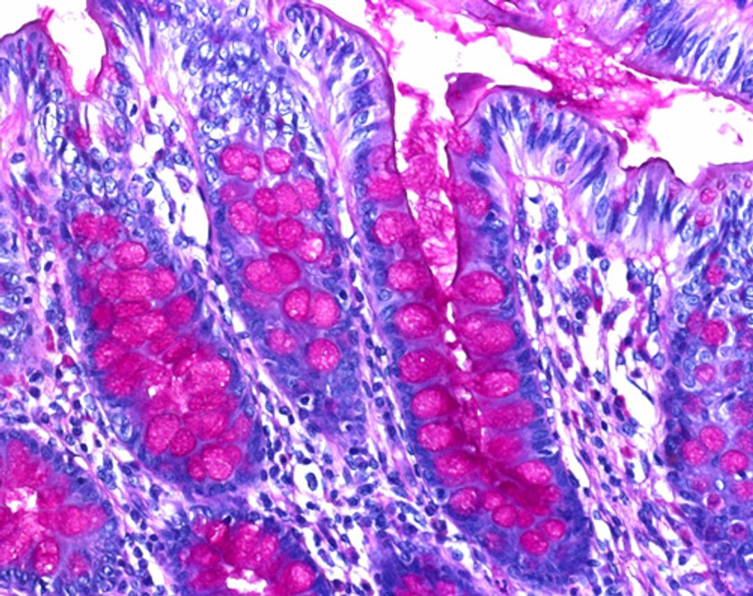 Schiff's reagent Intense - Merck KGaA, Darmstadt, Germany - Clinical Diagnostics