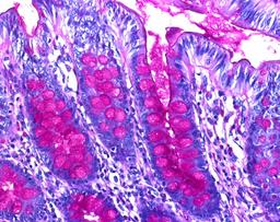 Schiff's reagent Intense - Merck KGaA, Darmstadt, Germany - Clinical Diagnostics