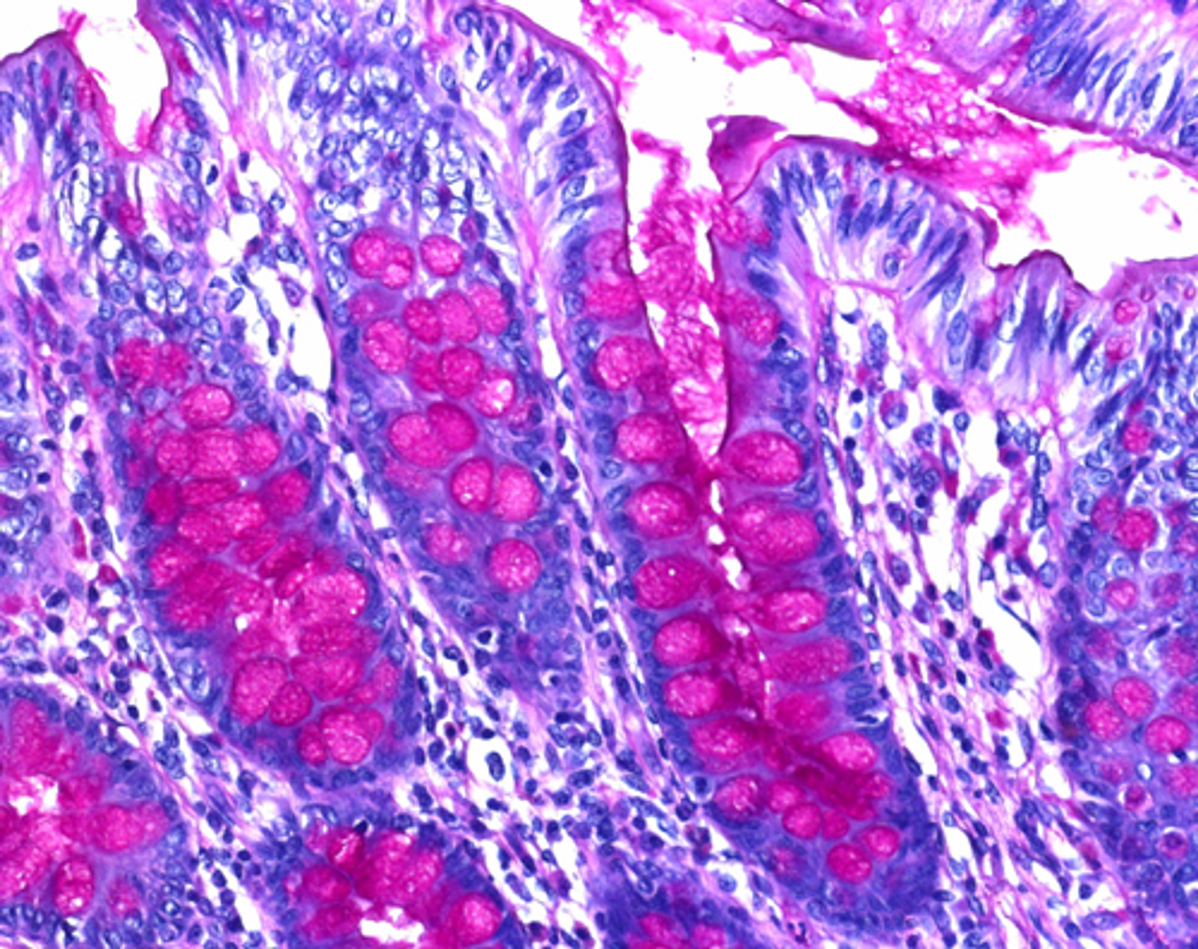 Schiff's reagent Intense - Merck KGaA, Darmstadt, Germany - Clinical Diagnostics