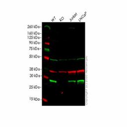 Human ANP32B (PHAPI2/APRIL) knockout HEK293T cell line - Abcam plc - Life Sciences