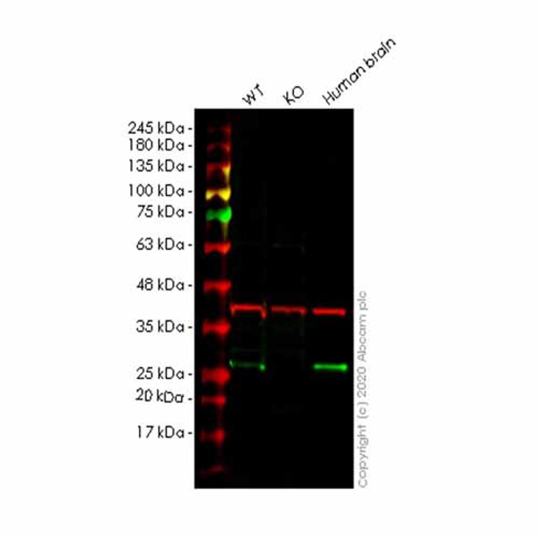 Human MRAS knockout HeLa cell line - Abcam plc - Life Sciences