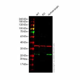 Human MRAS knockout HeLa cell line - Abcam plc - Life Sciences