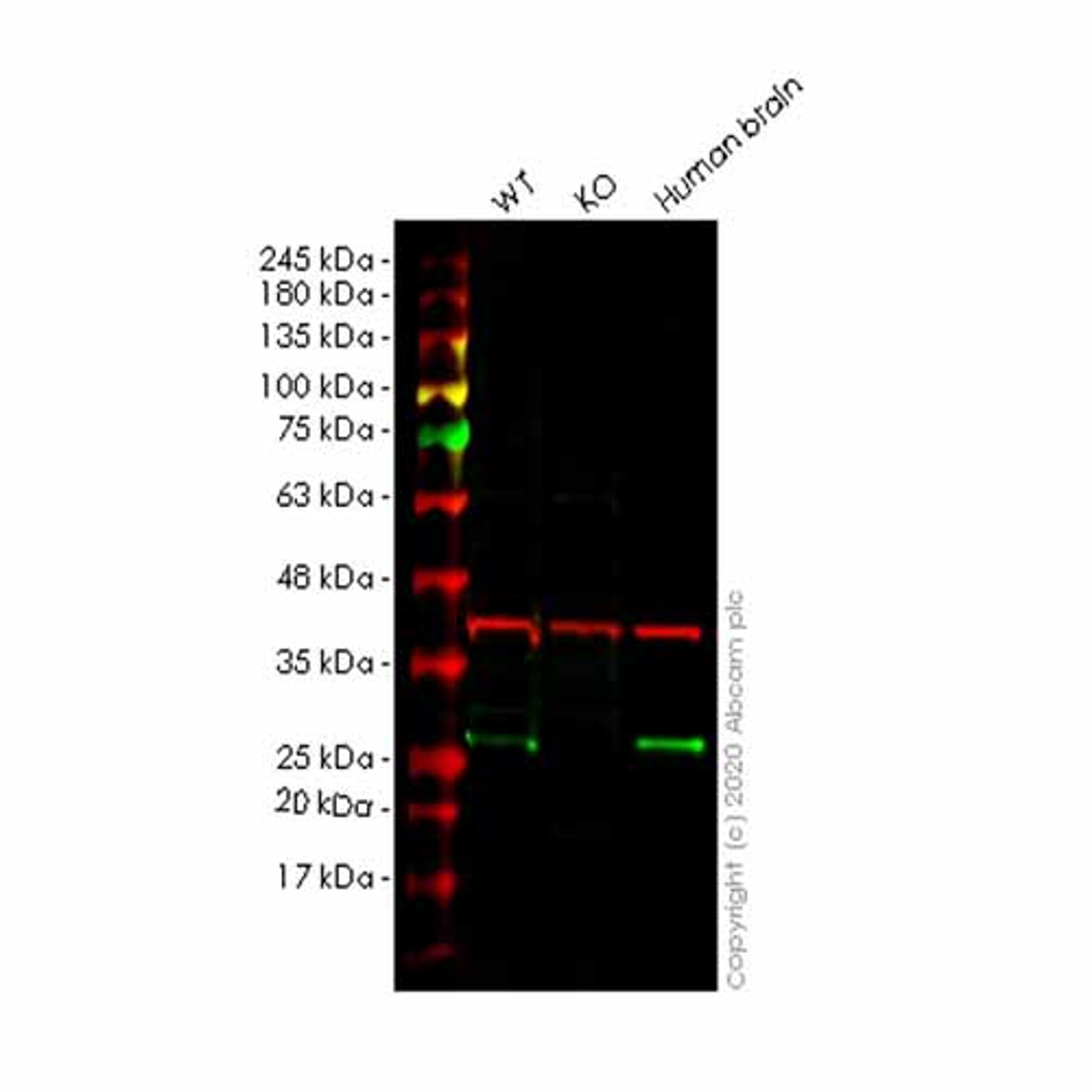 Human MRAS knockout HeLa cell line - Abcam plc - Life Sciences