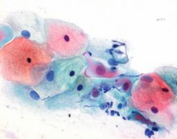 M-GLAS™ - Merck KGaA, Darmstadt, Germany - Clinical Diagnostics