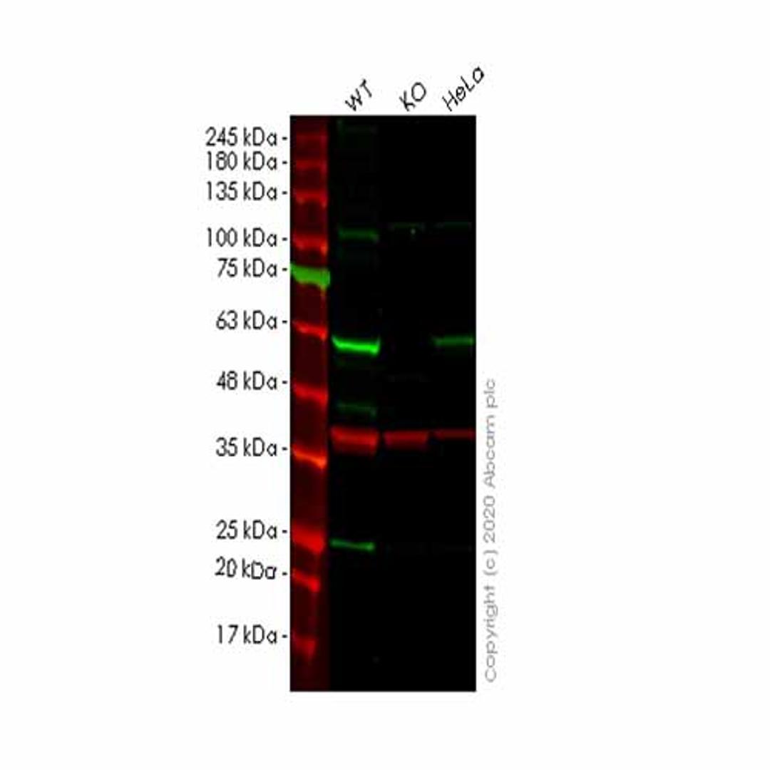 Human SESN2 (Sestrin-2) knockout HeLa cell line - Abcam plc - Life Sciences