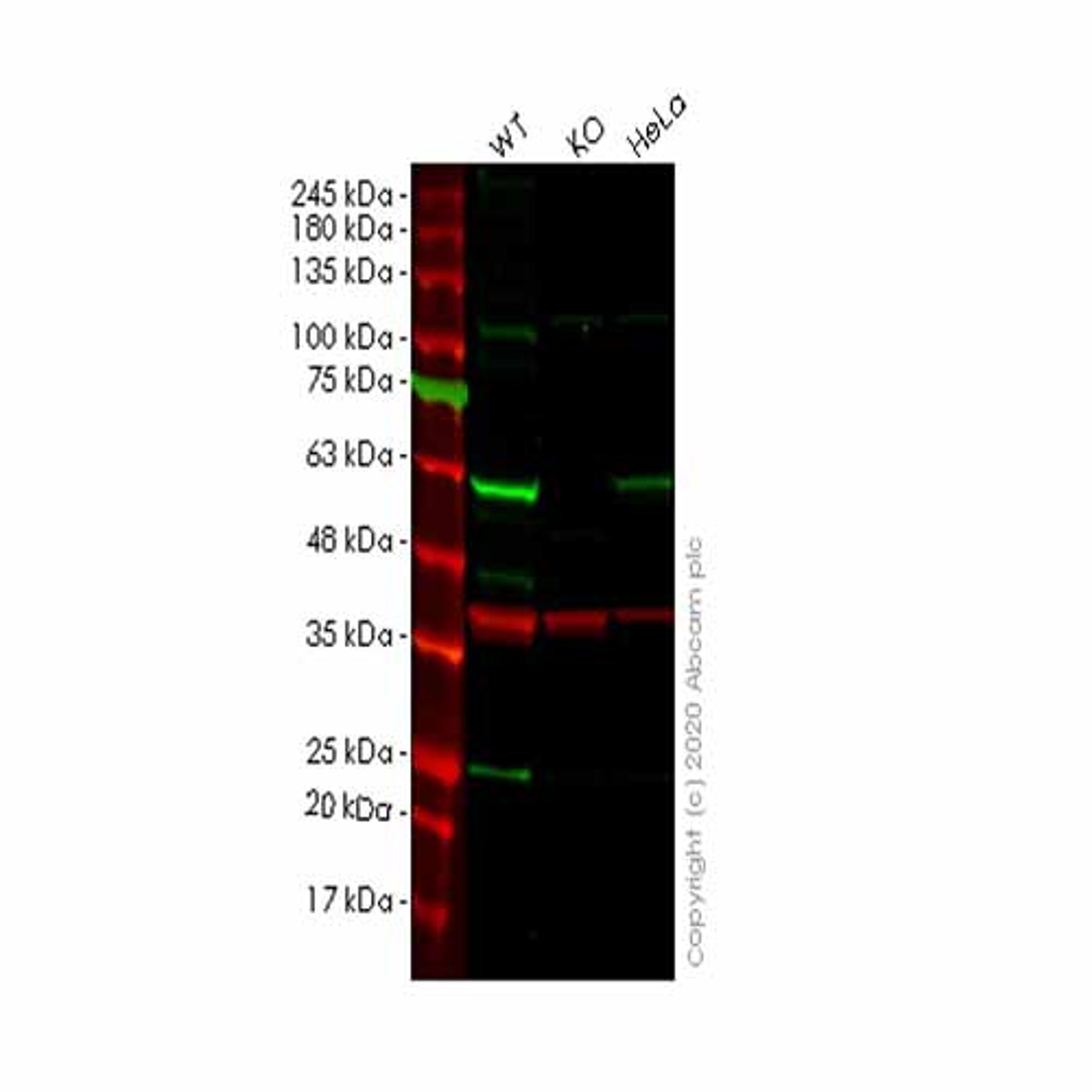 Human SESN2 (Sestrin-2) knockout HeLa cell line - Abcam plc - Life Sciences