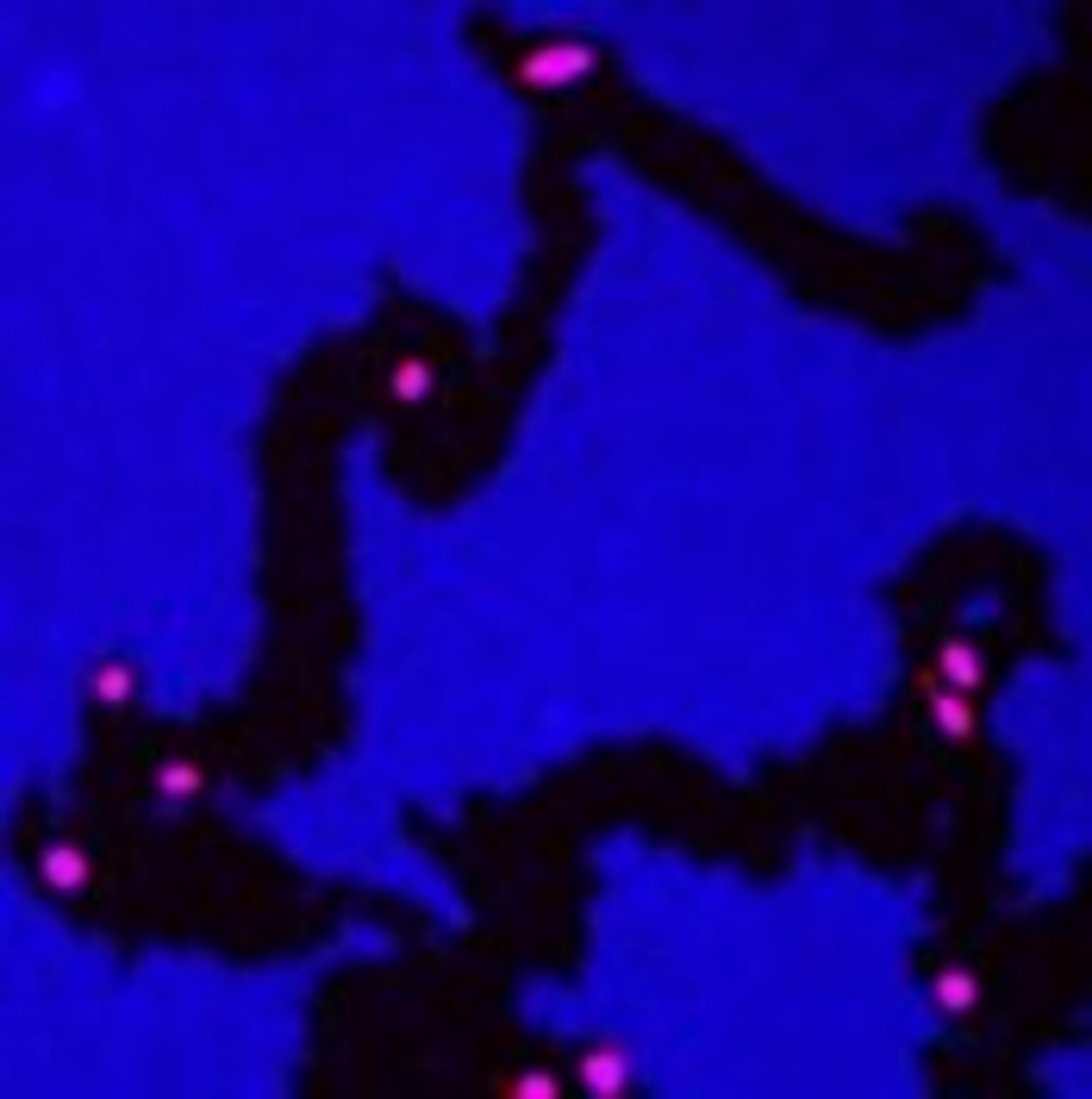 Cell Motility V2 Image Analysis BioApplication for Cancer Research - null - Life Sciences