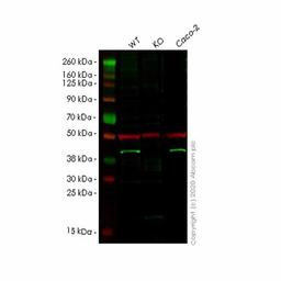 Human HPDL knockout HeLa cell line - Abcam plc - Life Sciences