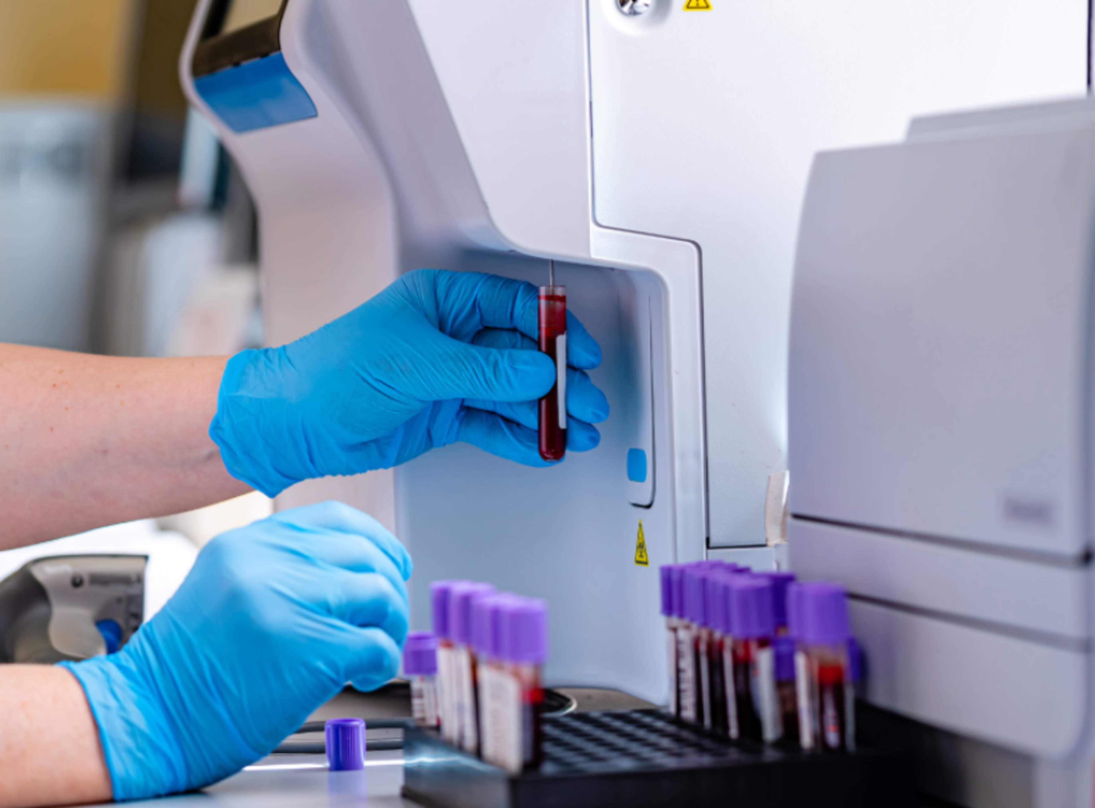 Hematology Analyzers and Staining Solutions Buying Guide 2025