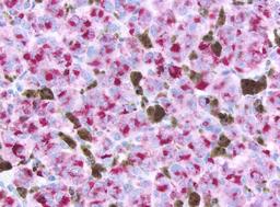 Immunohistochemistry Reagents