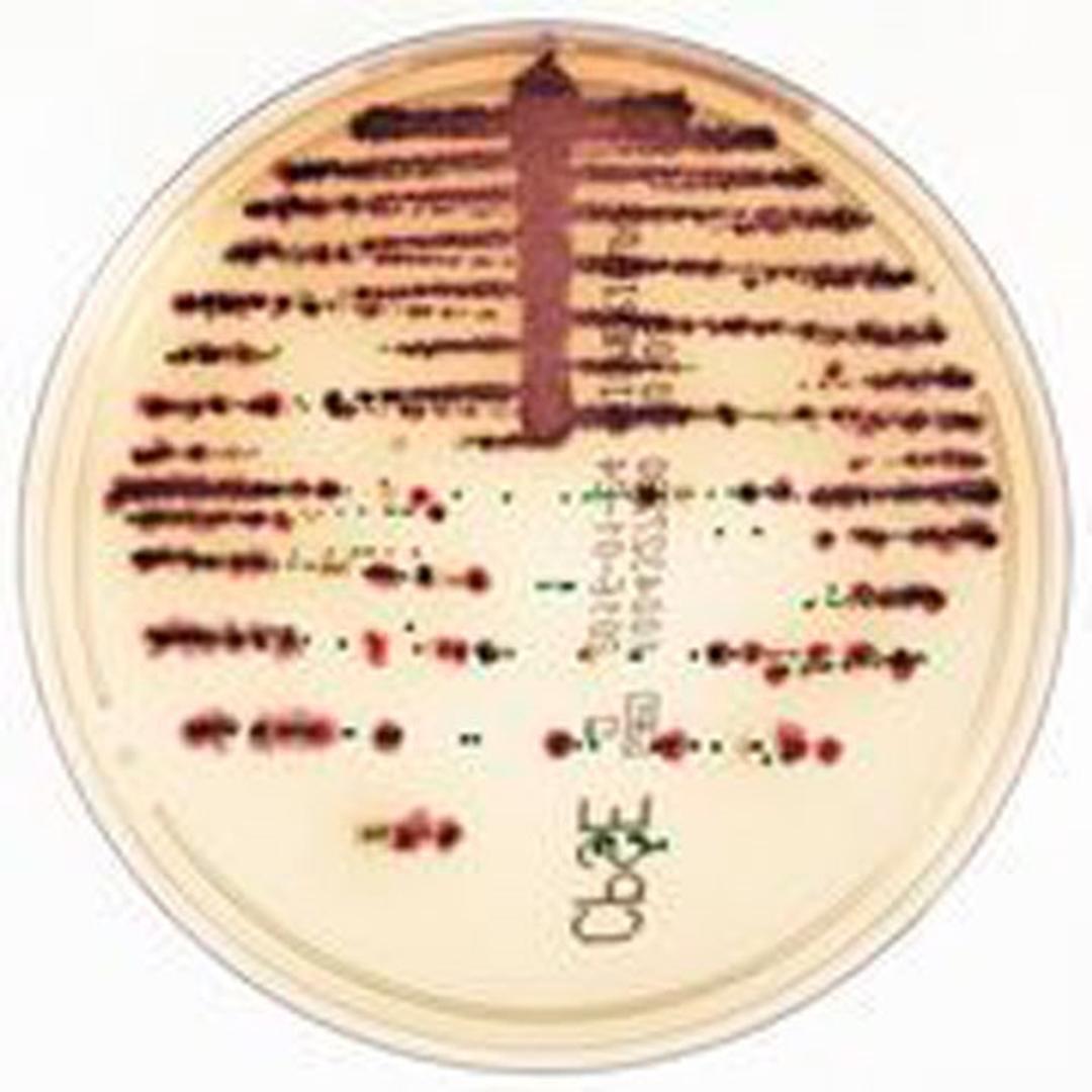 CHROMID® - bioMérieux USA - Life Sciences