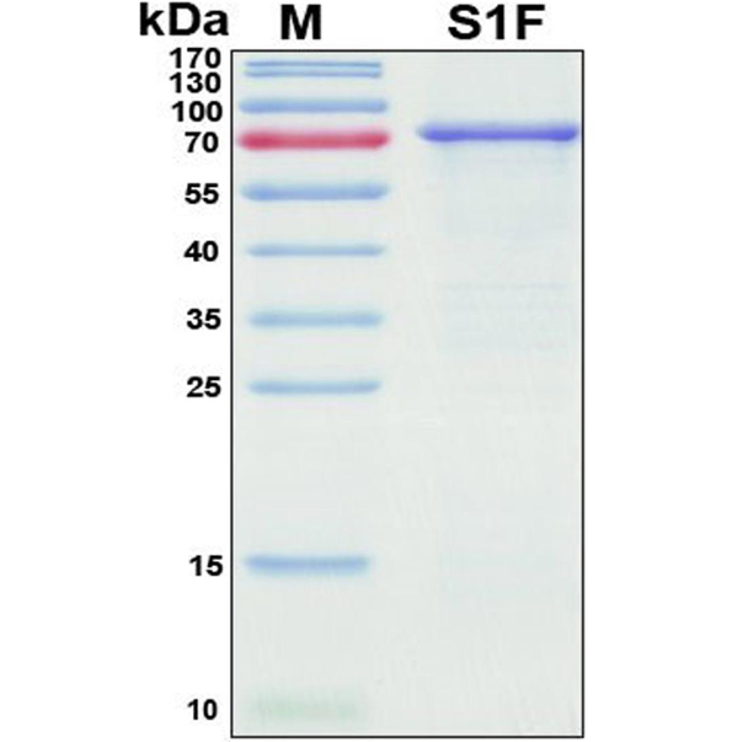 Recombinant SARS-CoV-2 Spike Protein, S1 Subunit - RayBiotech Inc. - Life Sciences