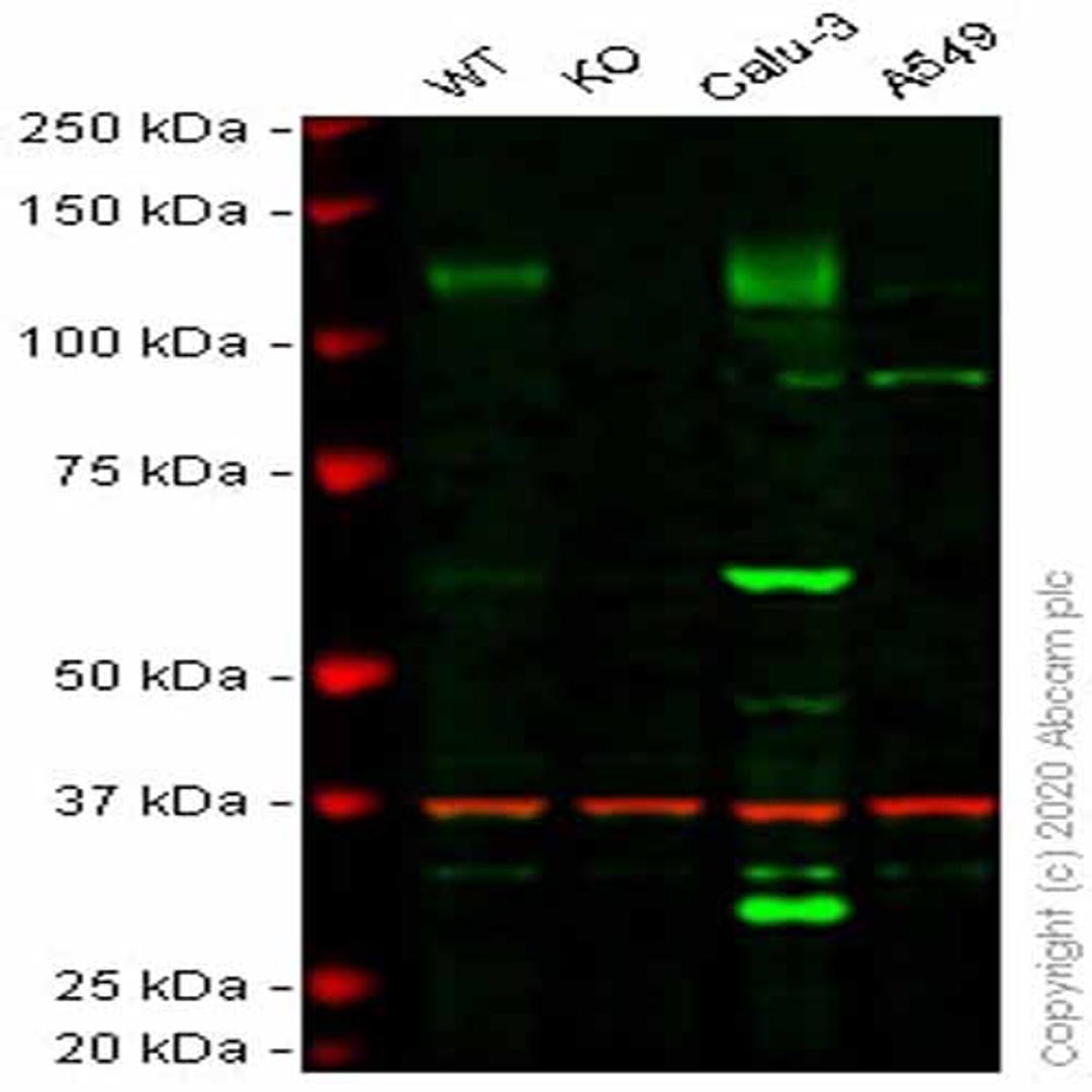Human ACE2 knockout HepG2 cell line - Abcam plc - Life Sciences