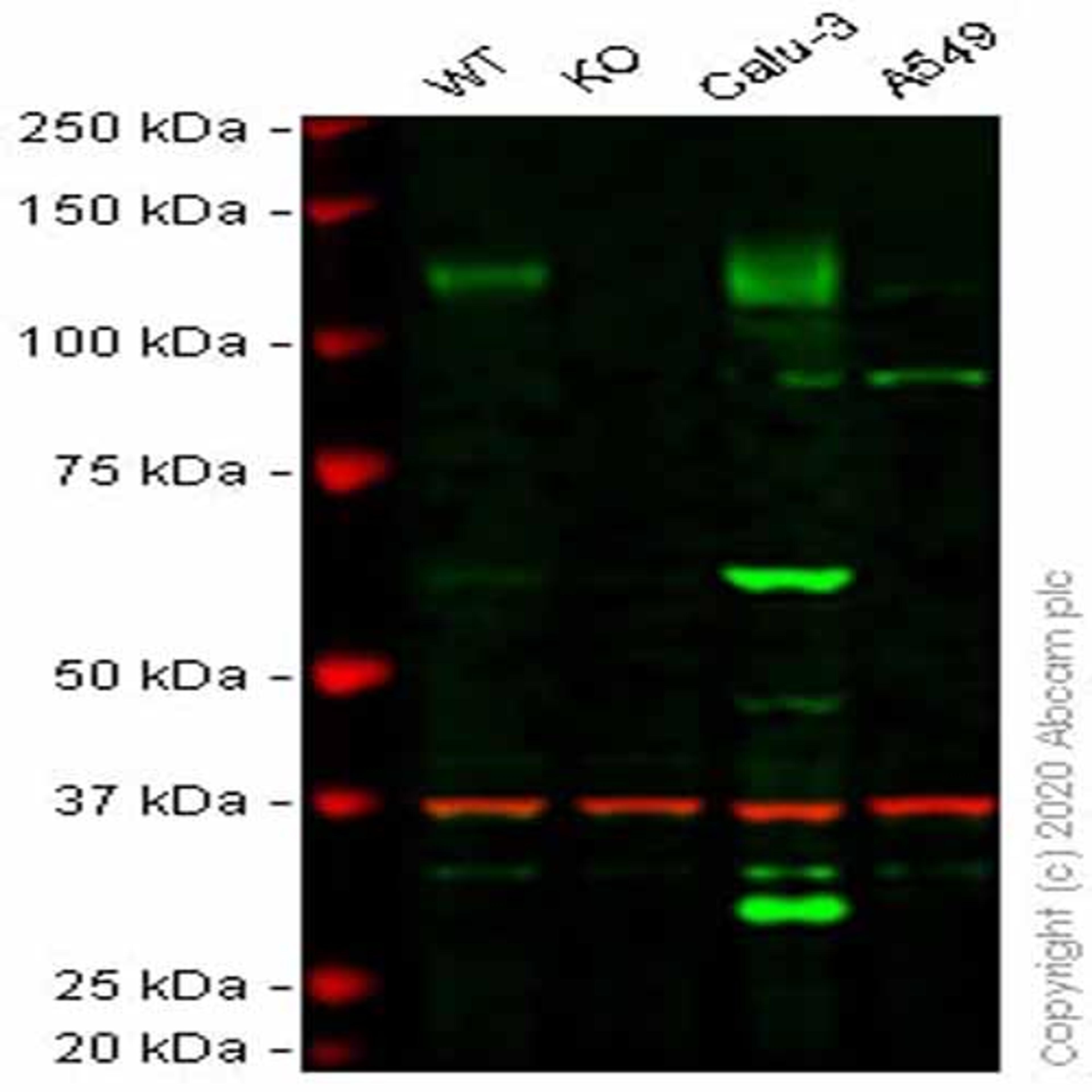 Human ACE2 knockout HepG2 cell line - Abcam plc - Life Sciences
