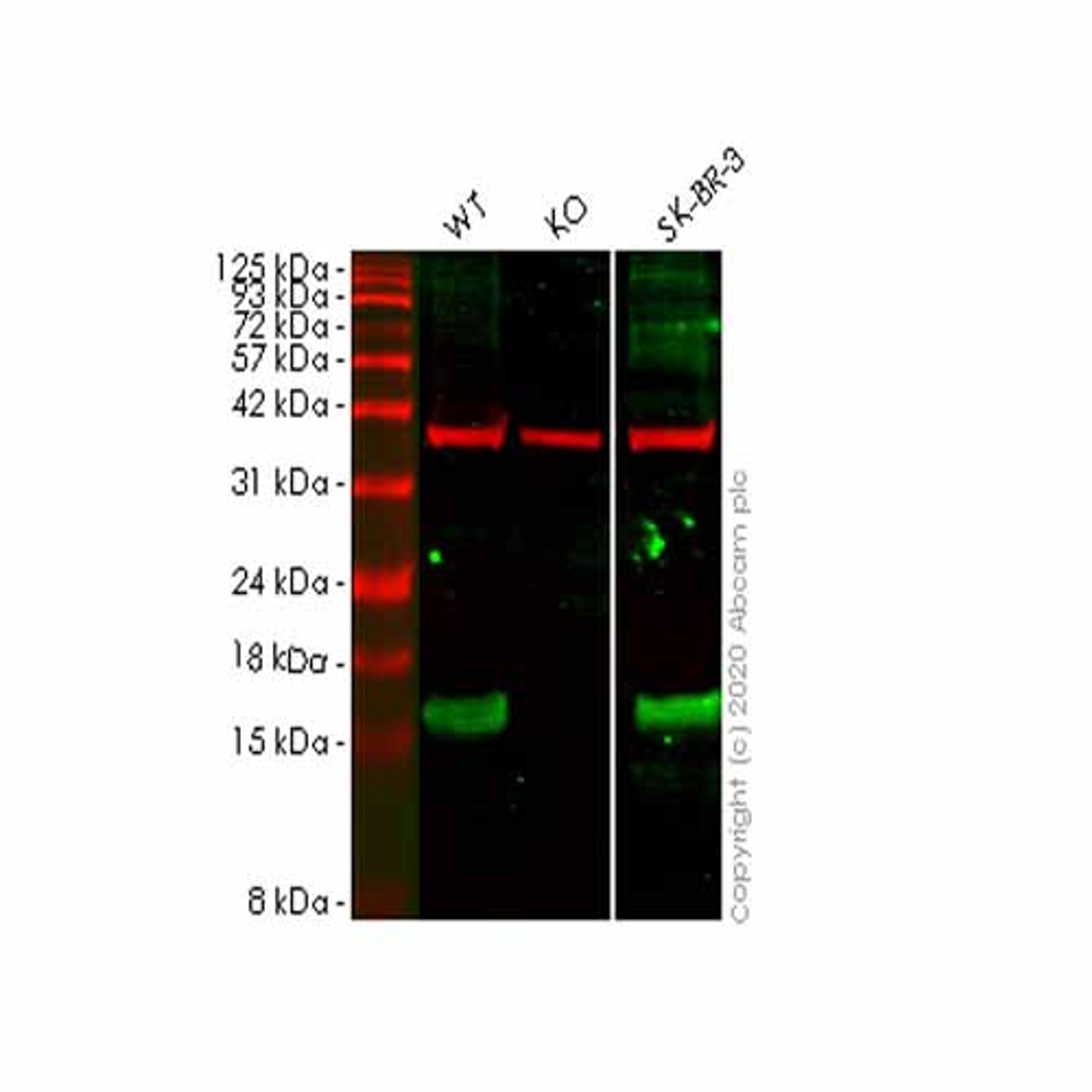 Human SNCG (gamma Synuclein) knockout HeLa cell line - Abcam plc - Life Sciences