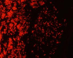 TB-Fluor phenol-free - Merck KGaA, Darmstadt, Germany - Clinical Diagnostics