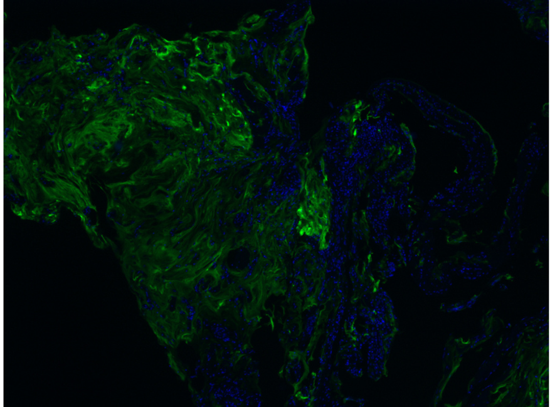 Purified Antibodies - Merck - Life Sciences