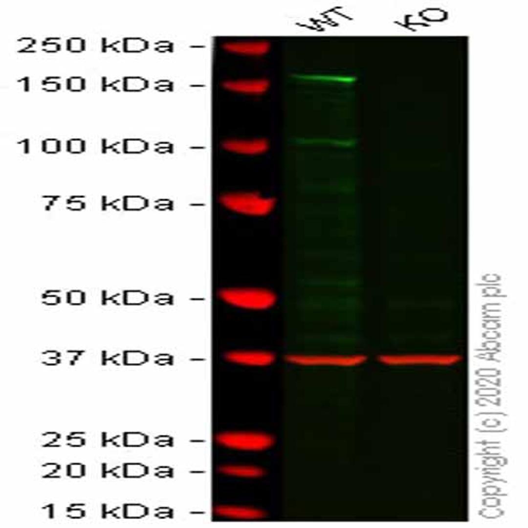 Human DIAPH1 knockout HCT116 cell line - Abcam plc - Life Sciences