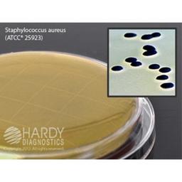 Baird-Parker Agar - Hardy Diagnostics - Life Sciences