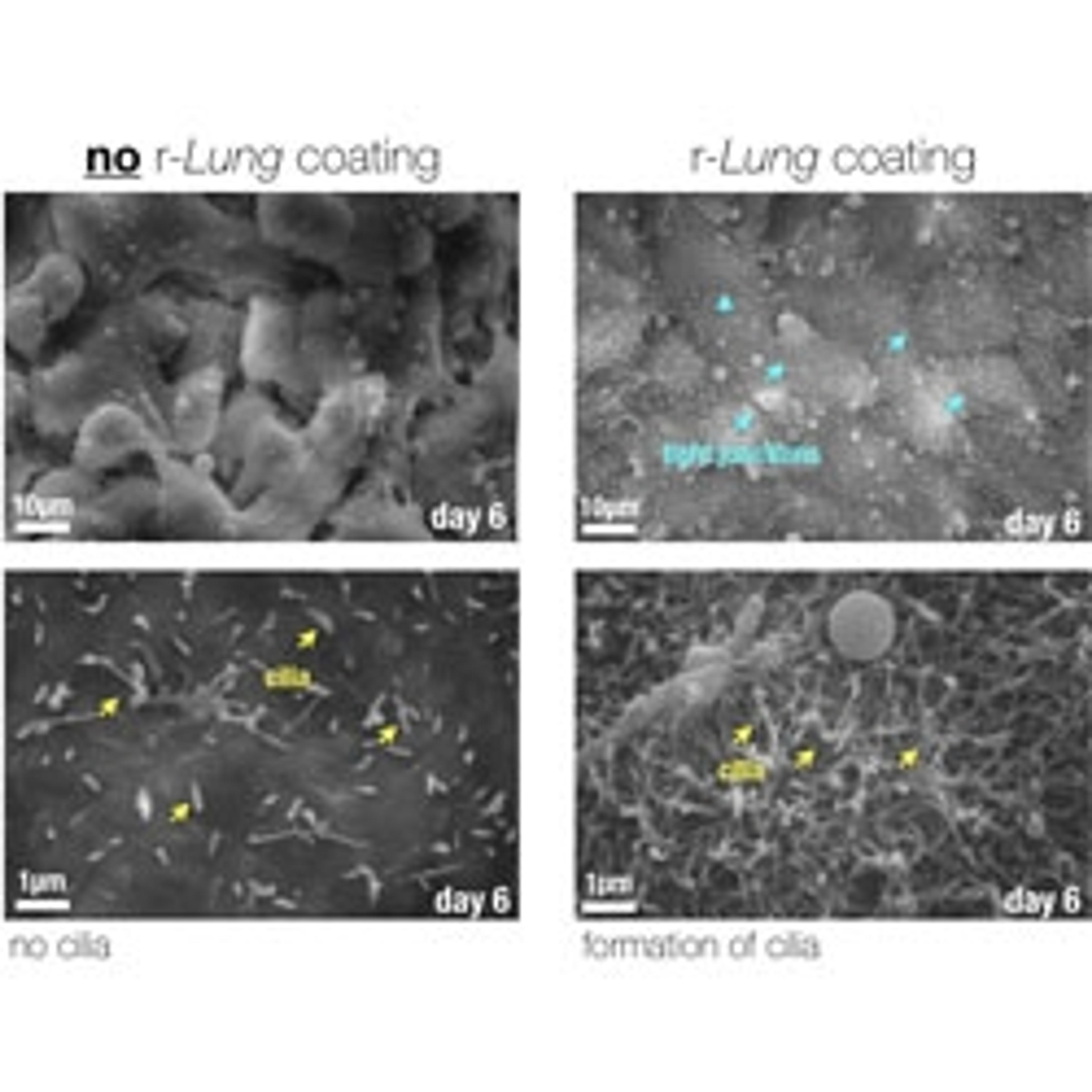 r-Lung-SARS-CoV-2 model - zPREDICTA - Life Sciences