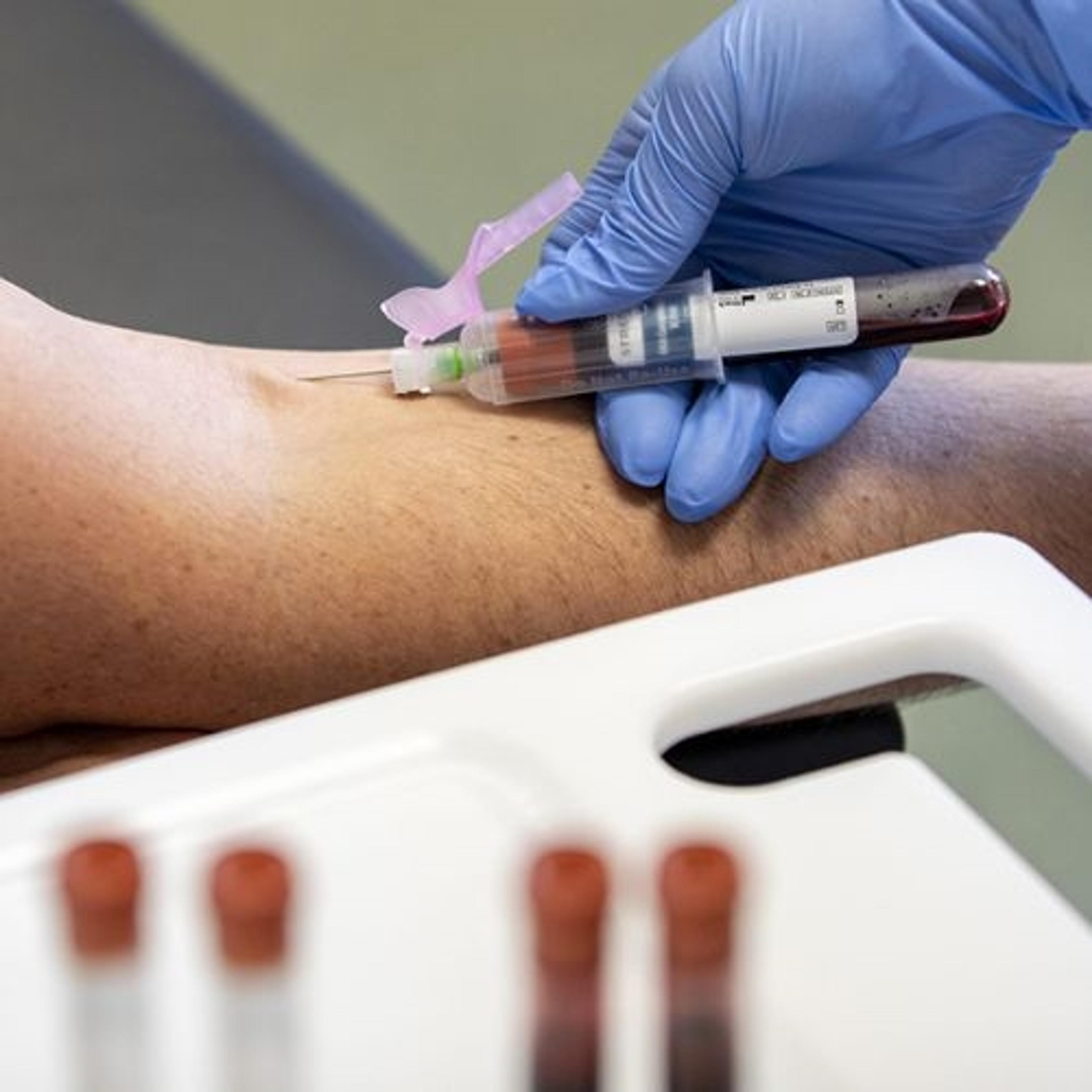 Blood Collection Tubes - Alpha Laboratories Ltd - Lab Automation