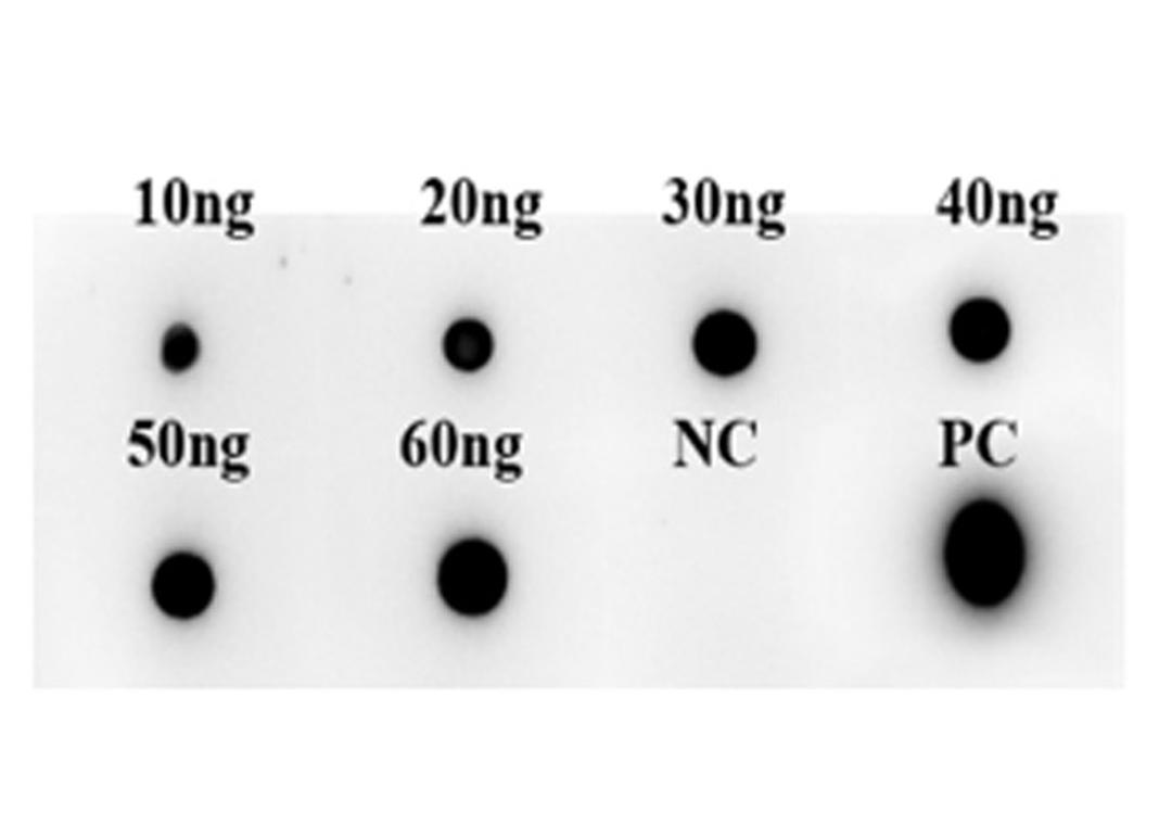 Recombinant Human Anti-TSHR Antibody (M22) - Creative Biolabs - Life Sciences
