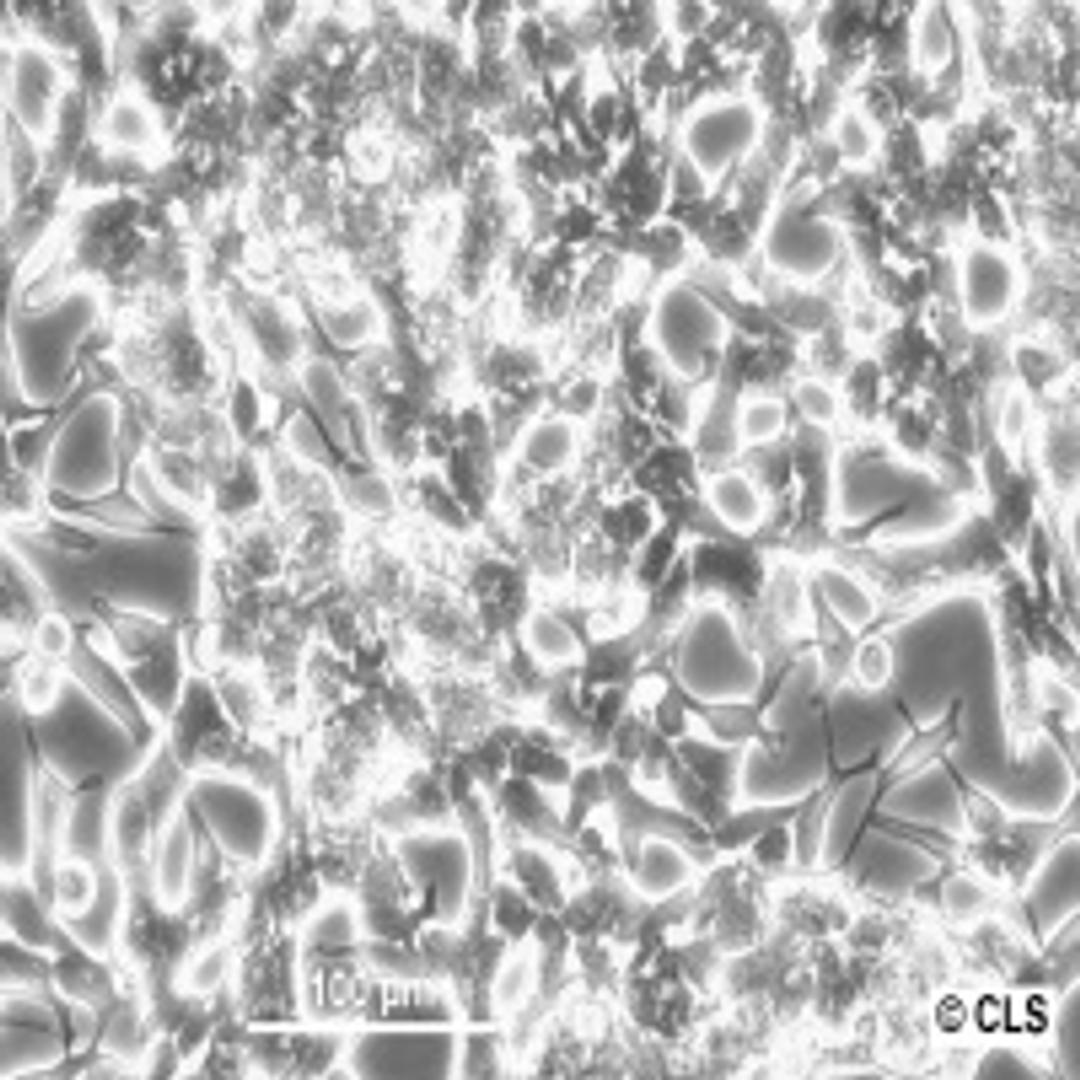 LNCaP - Cell Lines Service GmbH - Life Sciences